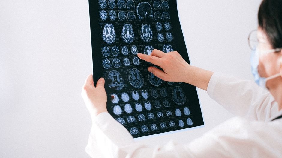 A brain scan shows uneven activation patterns compared to a visual stimulus image highlighting the gap in targeting specific regions with AI-generated videos brain activation