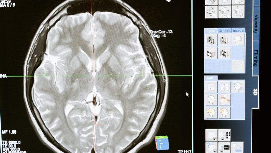 A brain scan shows increased activity in social and dynamic processing areas as AI-generated videos trigger complex visual responses